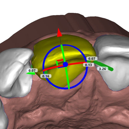 Logiciel-Logiciel de Conception 3D de gouttières aligneurs pour l'Orthodontie DeltaFace Aligner- DELTAFACE - KALLISTO