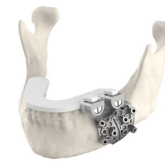 Métier : Logiciels 3D numériques pour les Dispositifs Médicaux - KALLISTO