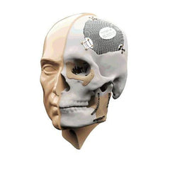 Métier : Scanners 3D et outil de prise d'empreinte de table et intra-oral pour le maxillo Facial - KALLISTO