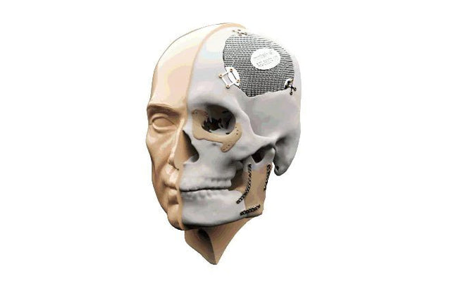 Métier : Scanners 3D et outil de prise d'empreinte de table et intra-oral pour le maxillo Facial - KALLISTO