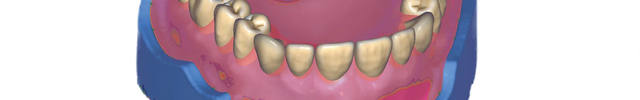 Dentition et gencives logiciel 3D