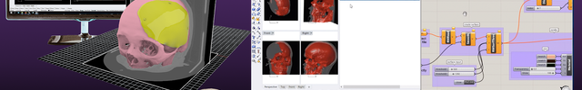 Rhino 3D Medical capture maxilo facial