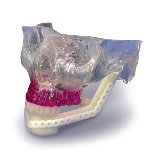 Matériaux - Matériau (imprimante 3D SLA) : Accura SL Y - C 9300 - 3D SYSTEMS - KALLISTO