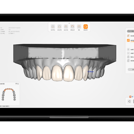 Logiciel-Logiciel CAO - Dentaire - UP3D UPCAD- UP3D - KALLISTO