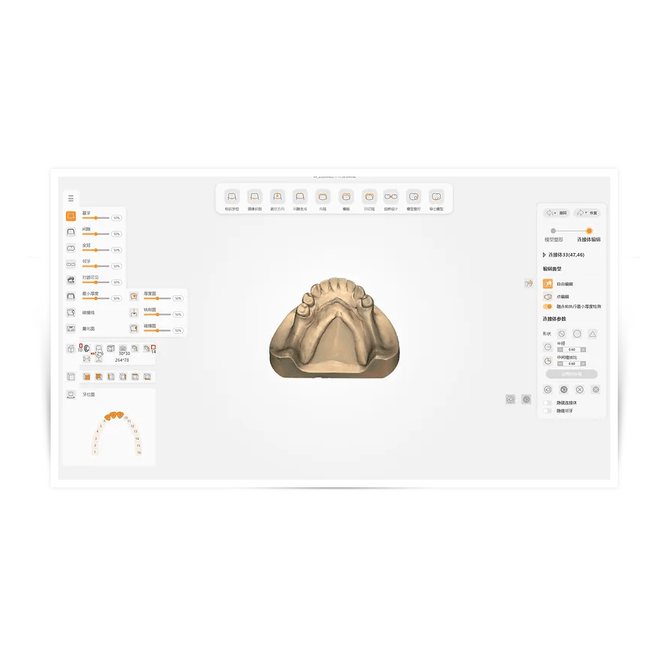 Logiciel-Logiciel CAO - Dentaire - UP3D UPCAD- UP3D - KALLISTO