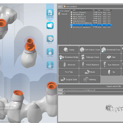 Logiciel-Logiciel - Dentaire - CIMsystem MillBox- CIMsystem - KALLISTO