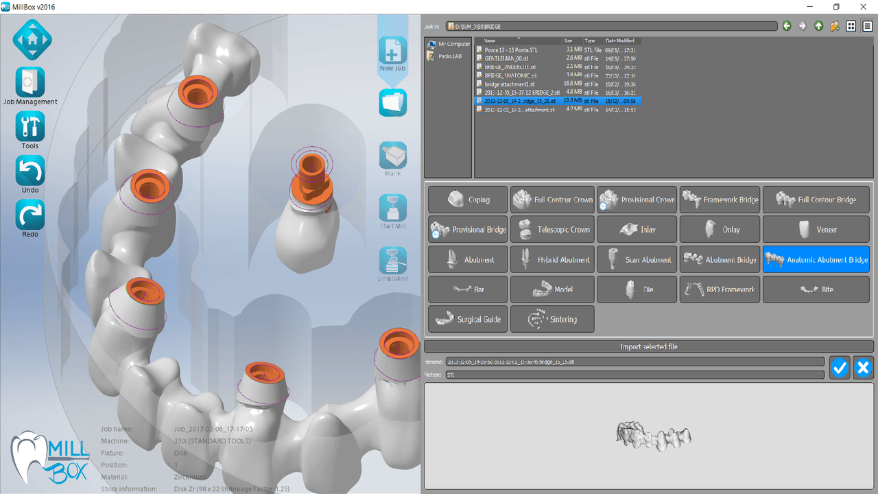 Logiciel - Dentaire - CIMsystem MillBox de chez CIM SYSTEM – KALLISTO