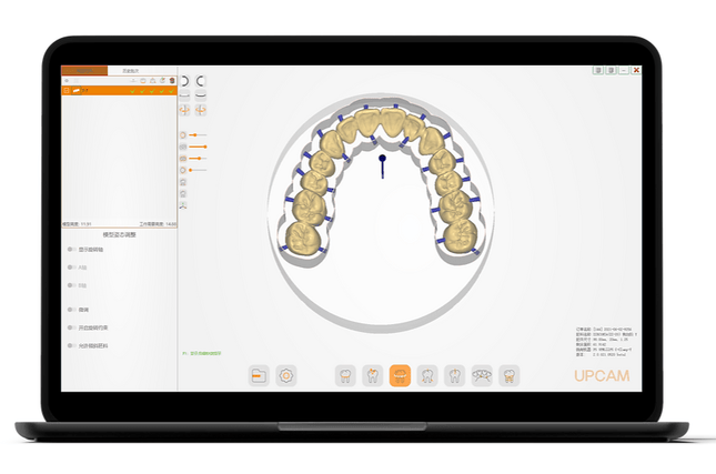 Logiciel-Logiciel FAO - Dentaire - UP3D UPCAM- UP3D - KALLISTO