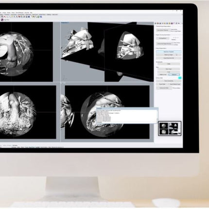 Logiciel-Logiciel Rhino3DMedical Dicom vers Stl (IRM)- MIRRAKOI - KALLISTO