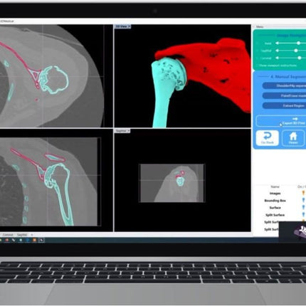 Logiciel-Logiciel Rhino3DMedical Dicom vers Stl (IRM)- MIRRAKOI - KALLISTO