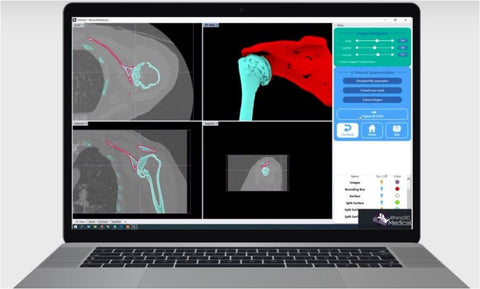 Logiciel Rhino3DMedical Dicom vers Stl (IRM)