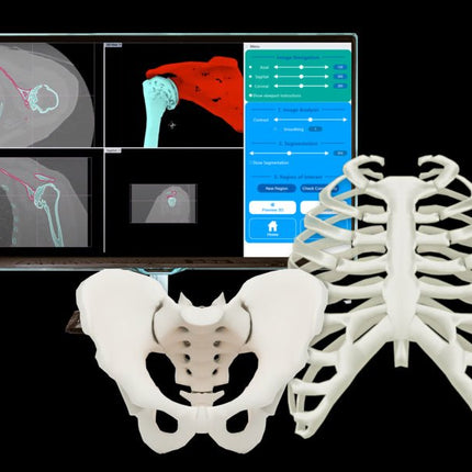 Logiciel-Logiciel Rhino3DMedical Dicom vers Stl (IRM)- MIRRAKOI - KALLISTO