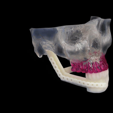 Matériaux-Matériau (imprimante 3D SLA) : Accura SL Y-C 9300- 3D SYSTEMS - KALLISTO