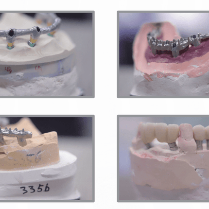 Machine-Scanner 3D - Dentaire - UP3D UP1000- UP3D - KALLISTO